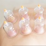 dr_umer_cupping_session